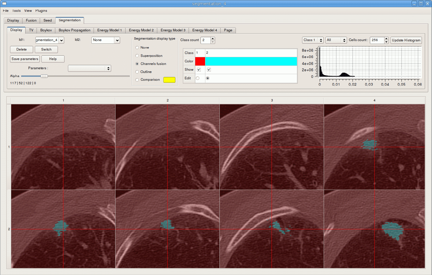 VLVDP Screenshot